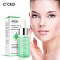 Green Tea Tree Oil for Face Care Acne Treatment