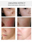 Green Tea Tree Oil for Face Care Acne Treatment